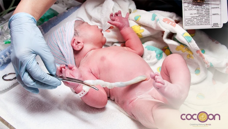 Understanding Newborn Umbilical Cord Care: Why It Matters