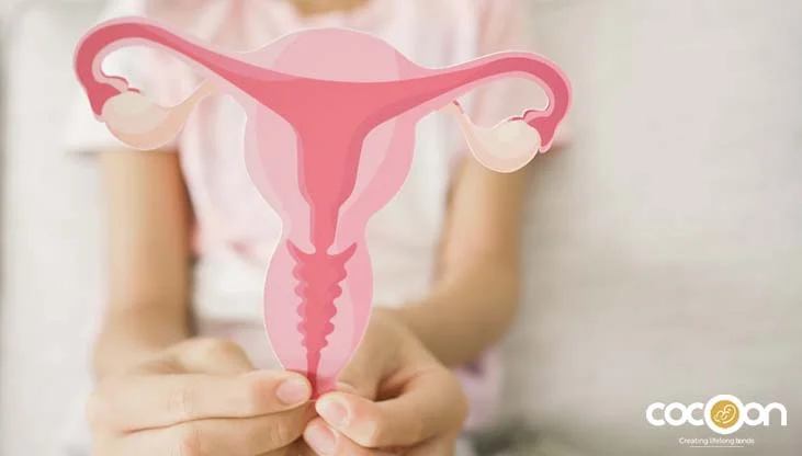 Endometriosis Vs. PCOS: Understanding Symptoms, Pain Relief & Treatment Options