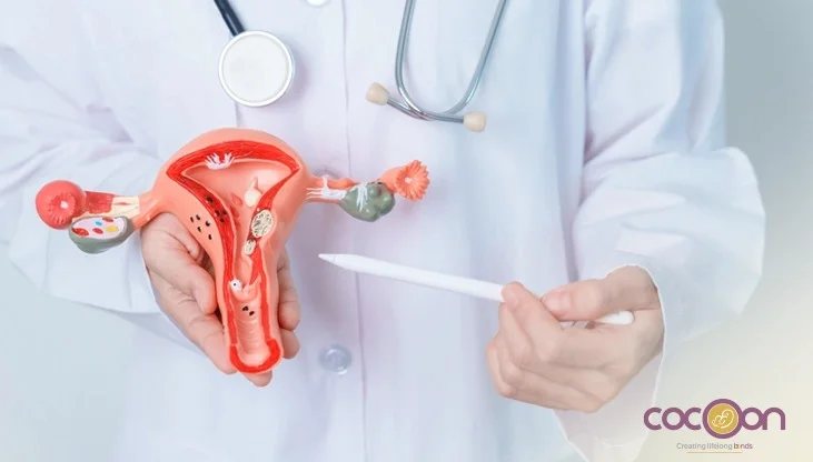 Fibroids vs. Cysts: Key Differences and When to Seek Medical Advice